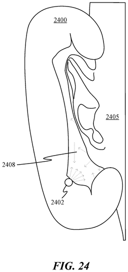 EMI-D00044